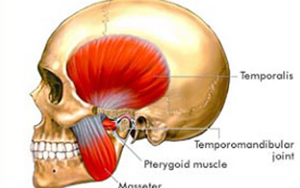 Can Tmj Cause Temporal Pain