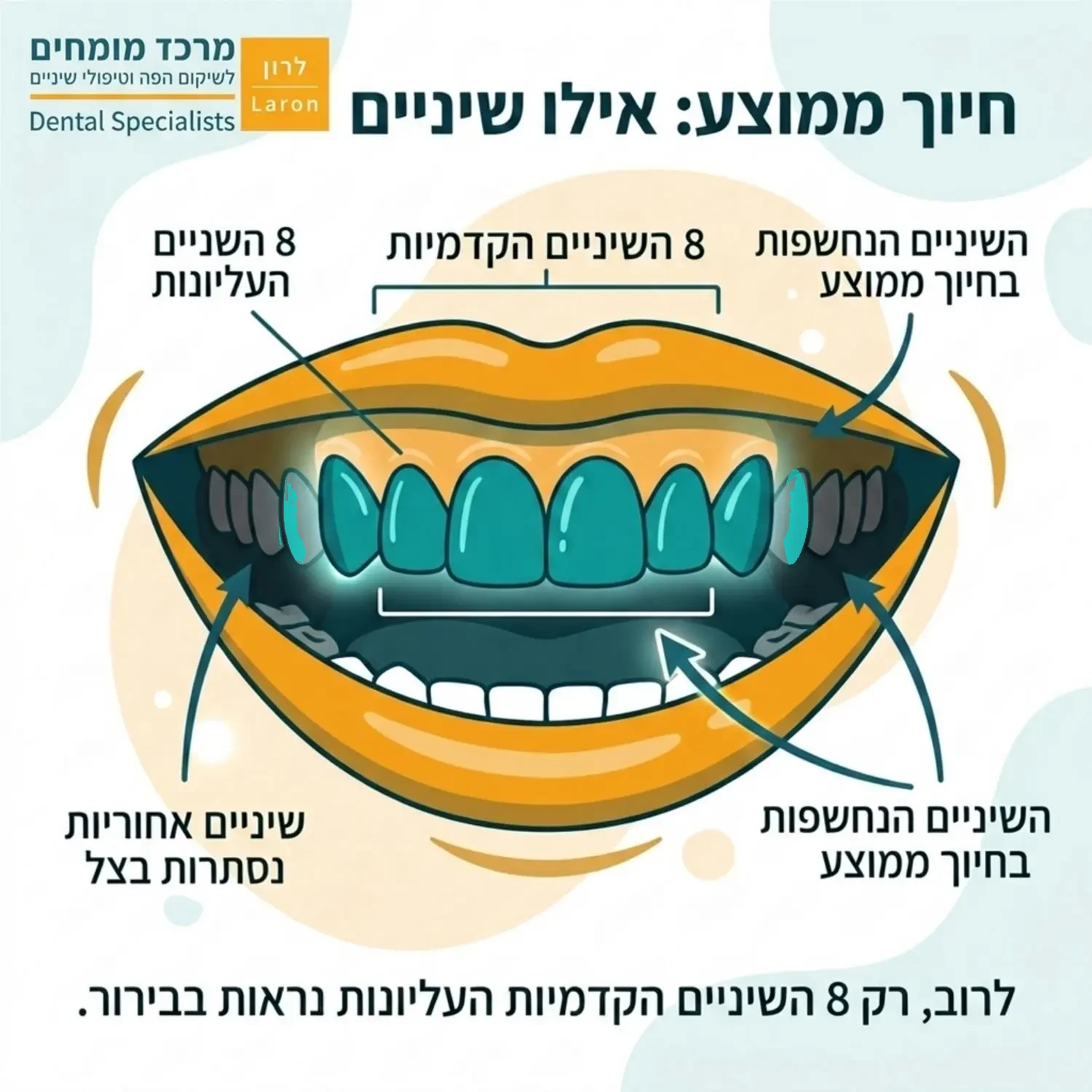 אינפוגרפיקה המציגה חיוך רחב עם סימון ברור של 8 השיניים הקדמיות העליונות בצבע אחד, הממחישה אילו שיניים נחשפות בזמן חיוך ממוצע לעומת השיניים האחוריות הנסתרות בצל.