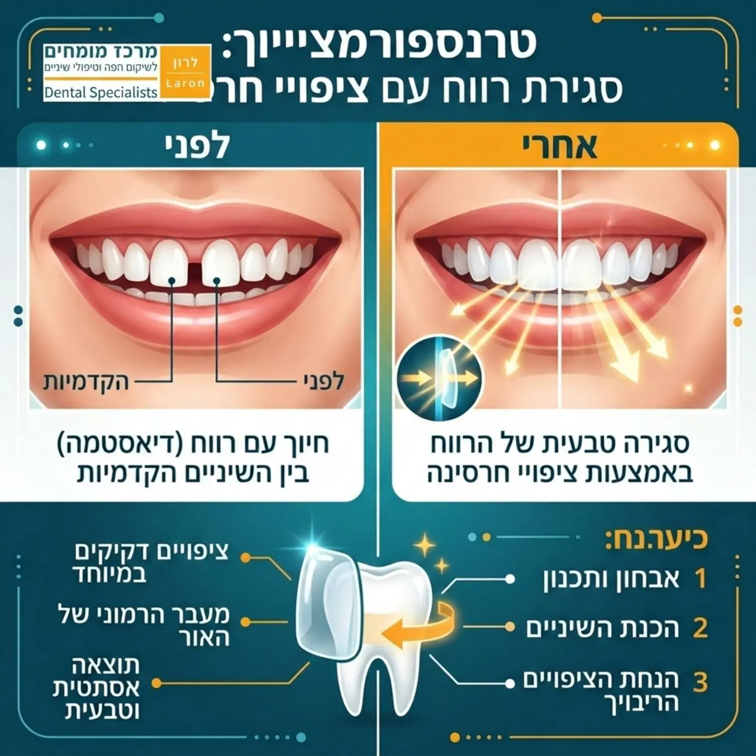 אינפוגרפיקה מפורטת המציגה חיוך עם רווח בין שתי השיניים הקדמיות העליונות (דיאסטמה) בחלק הימני, ולעומת זאת אותו החיוך בחלק השמאלי לאחר הנחת ציפויי חרסינה דקיקים הסוגרים את הרווח בצורה טבעית, תוך המחשת המעבר ההרמוני של האור דרך החרסינה