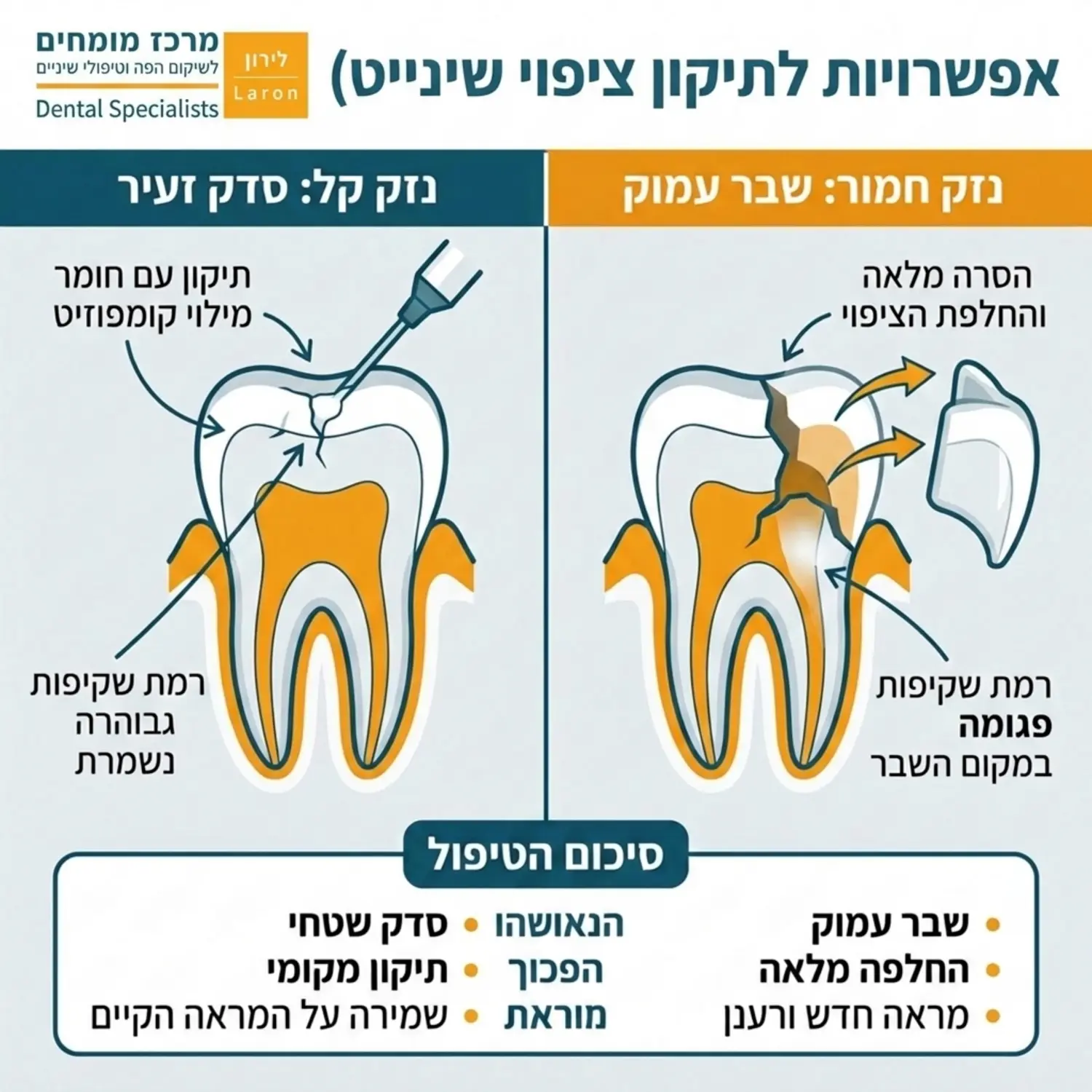 אינפוגרפיקה המציגה חתך רוחב של שן עם ציפוי. האינפוגרפיקה מחולקת לשני חצאים: צד אחד מראה סדק זעיר שניתן לתיקון עם חומר מילוי, והצד השני מראה שבר עמוק הדורש הסרה והחלפה מלאה של הציפוי. חצים וטקסט מסבירים את ההבדלים ברמת השקיפות