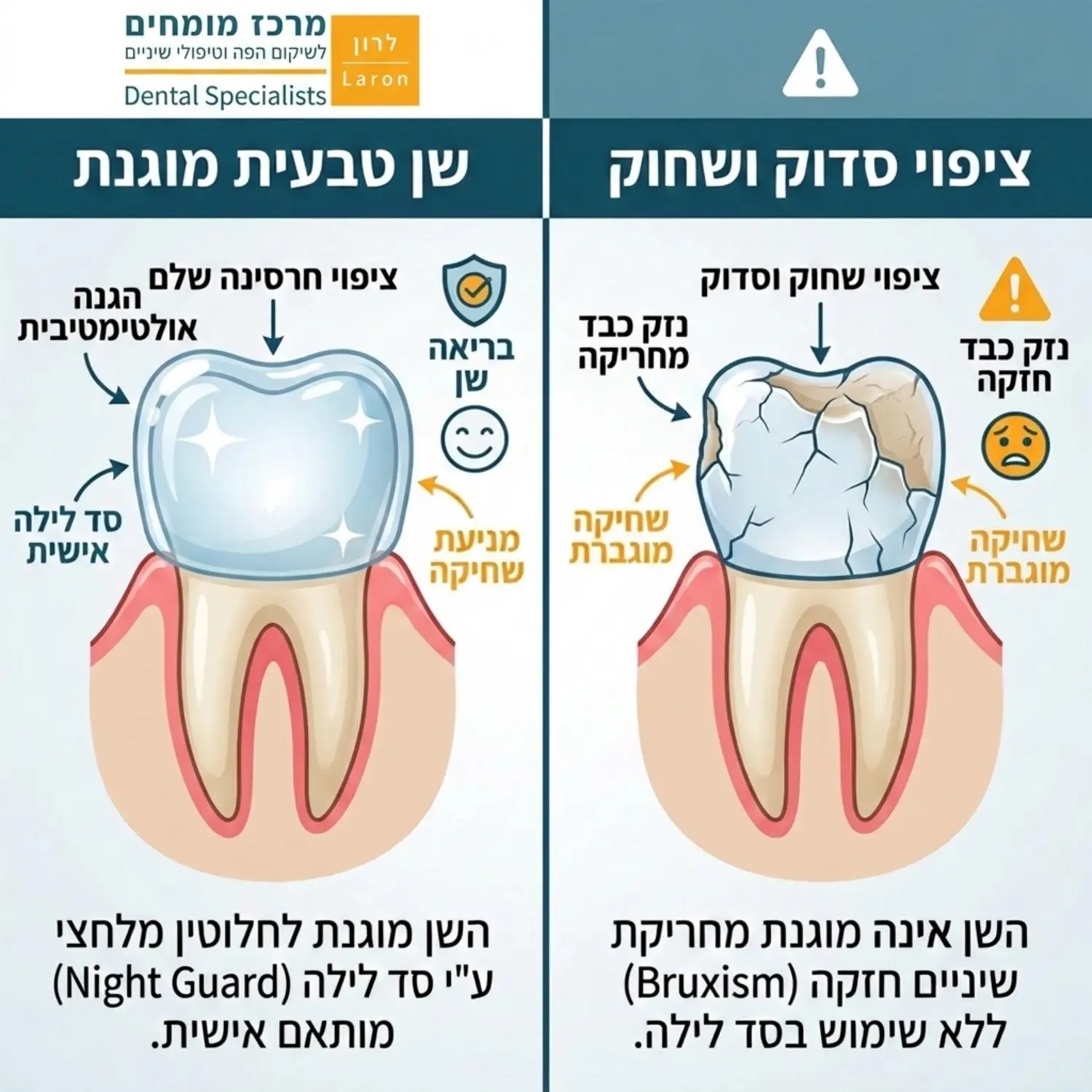 אינפוגרפיקה המחלקת את המסך לשניים: צד אחד מראה שן טבעית עם ציפוי חרסינה שלם ומוגן על ידי סד לילה, והצד השני מראה ציפוי סדוק ושחוק עקב חריקת שיניים ללא הגנה מתאימה